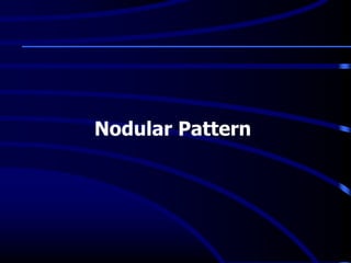 Nodular Pattern
 