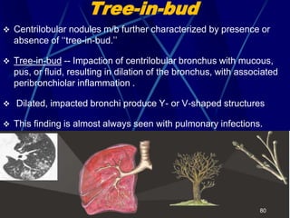 Tree-in-bud
 Centrilobular nodules m/b further characterized by presence or
absence of ‘‘tree-in-bud.’’
 Tree-in-bud -- Impaction of centrilobular bronchus with mucous,
pus, or fluid, resulting in dilation of the bronchus, with associated
peribronchiolar inflammation .
 Dilated, impacted bronchi produce Y- or V-shaped structures
 This finding is almost always seen with pulmonary infections.
80
 