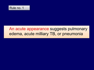 An acute appearance suggests pulmonary
edema, acute milliary TB, or pneumonia
Rule no. 1
 