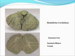 Hemisferios Cerebelosos




 Sustancia Gris

Sustancia Blanca
Vérmix
 