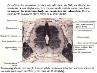 Fotomicrografia de uma secção transversal da medula espinhal em desenvolvimento de
um embrião humano de 20mm, com cerca de 50 dias(60x).
Os axônios dos neurônios da placa alar não saem do SNC; constituem os
neurônios de associação, em corte transversal da medula, estas constituem
os cornos dorsais(cinzentos)- os neurônios são aferentes. Com o
crescimento das placas alares forma-se o septo dorsal.
Corpos celulares das
placas alares
Corpos celulares das
placas basais
 