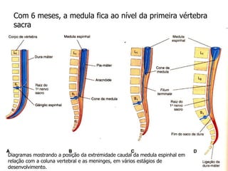 Com 6 meses, a medula fica ao nível da primeira vértebra
sacra
Diagramas mostrando a posição da extremidade caudal da medula espinhal em
relação com a coluna vertebral e as meninges, em vários estágios de
desenvolvimento.
 