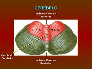 CEREBELO
            Incisura Cerebral
                 Anterior




Vermis do
Cerebelo
            Incisura Cerebral
                Posterior
 