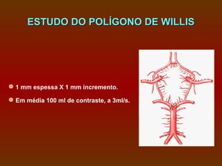 ESTUDO DO POLÍGONO DE WILLIS




 1 mm espessa X 1 mm incremento.

 Em média 100 ml de contraste, a 3ml/s.
 