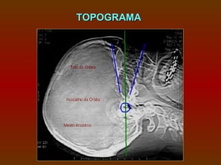 TOPOGRAMA
 