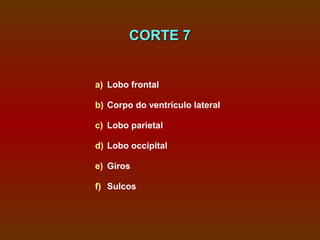 CORTE 7


a) Lobo frontal

b) Corpo do ventrículo lateral

c) Lobo parietal

d) Lobo occipital

e) Giros

f) Sulcos
 