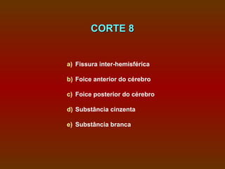 CORTE 8


a) Fissura inter-hemisférica

b) Foice anterior do cérebro

c) Foice posterior do cérebro

d) Substância cinzenta

e) Substância branca
 