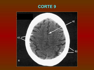CORTE 9
 