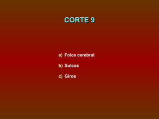 CORTE 9



a) Foice cerebral

b) Sulcos

c) Giros
 