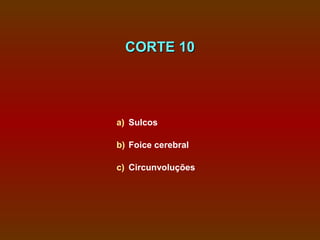 CORTE 10




a) Sulcos

b) Foice cerebral

c) Circunvoluções
 