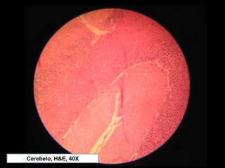 Cerebelo, H&E, 40X