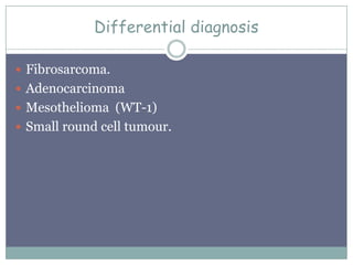 Differential diagnosis
 Fibrosarcoma.
 Adenocarcinoma
 Mesothelioma (WT-1)
 Small round cell tumour.
 
