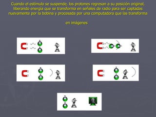Cuando el estímulo se suspende, los protones regresan a su posición original, liberando energía que se transforma en señal...