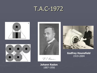 T.A.C-1972 Johann Radon   1887-1956  Godfrey Hounsfield   1919-2004 