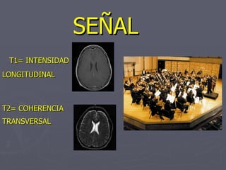 <ul><li>SEÑAL </li></ul><ul><li>T1= INTENSIDAD  </li></ul><ul><li>LONGITUDINAL </li></ul><ul><li>T2= COHERENCIA   </li></u...