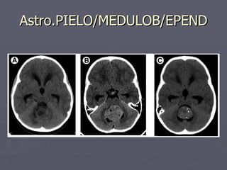 Astro.PIELO/MEDULOB/EPEND 