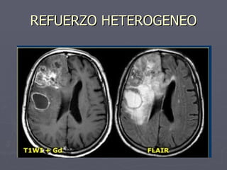 REFUERZO HETEROGENEO 