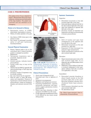 22 Bedside Medicine
51. What is pneumothorax?
Ans. Presence of air in the pleural cavity is called
pneumothorax.
52. How d...