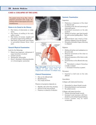 Clinical Case Discussion
69. What do you understand by the term collapse
of the lung?
Ans. Pulmonary collapse or atelectas...