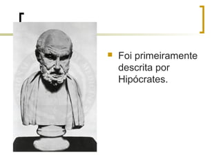    Foi primeiramente
    descrita por
    Hipócrates.
 