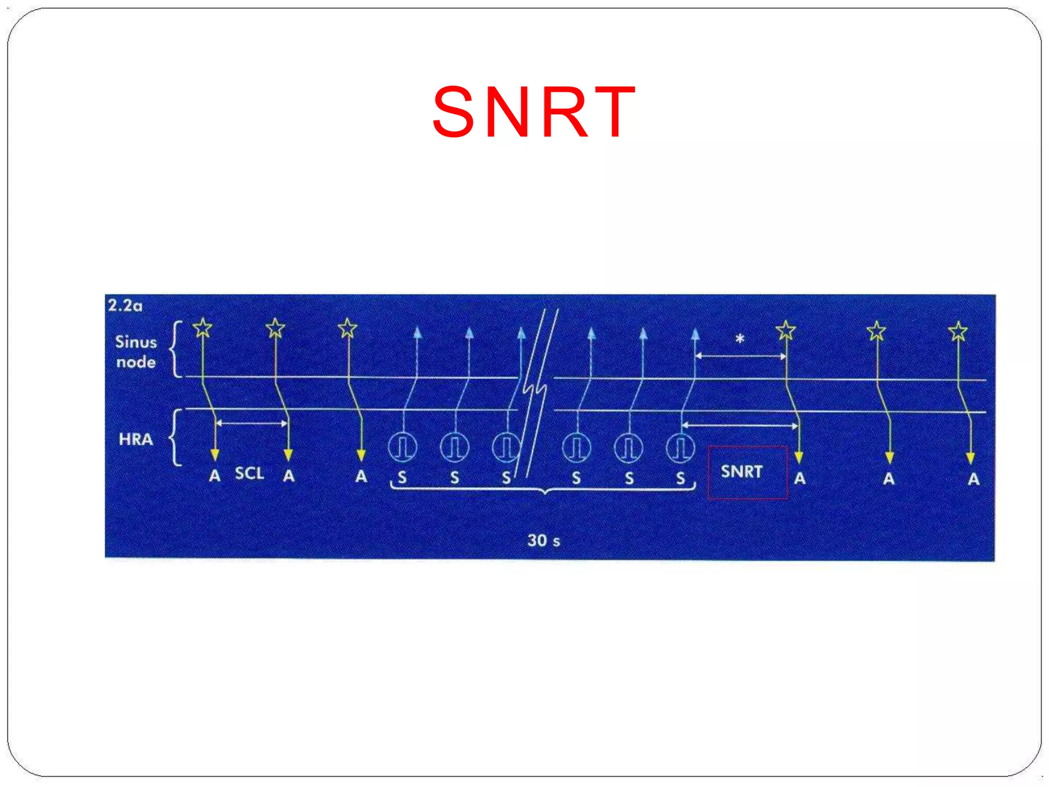 SNRT
 