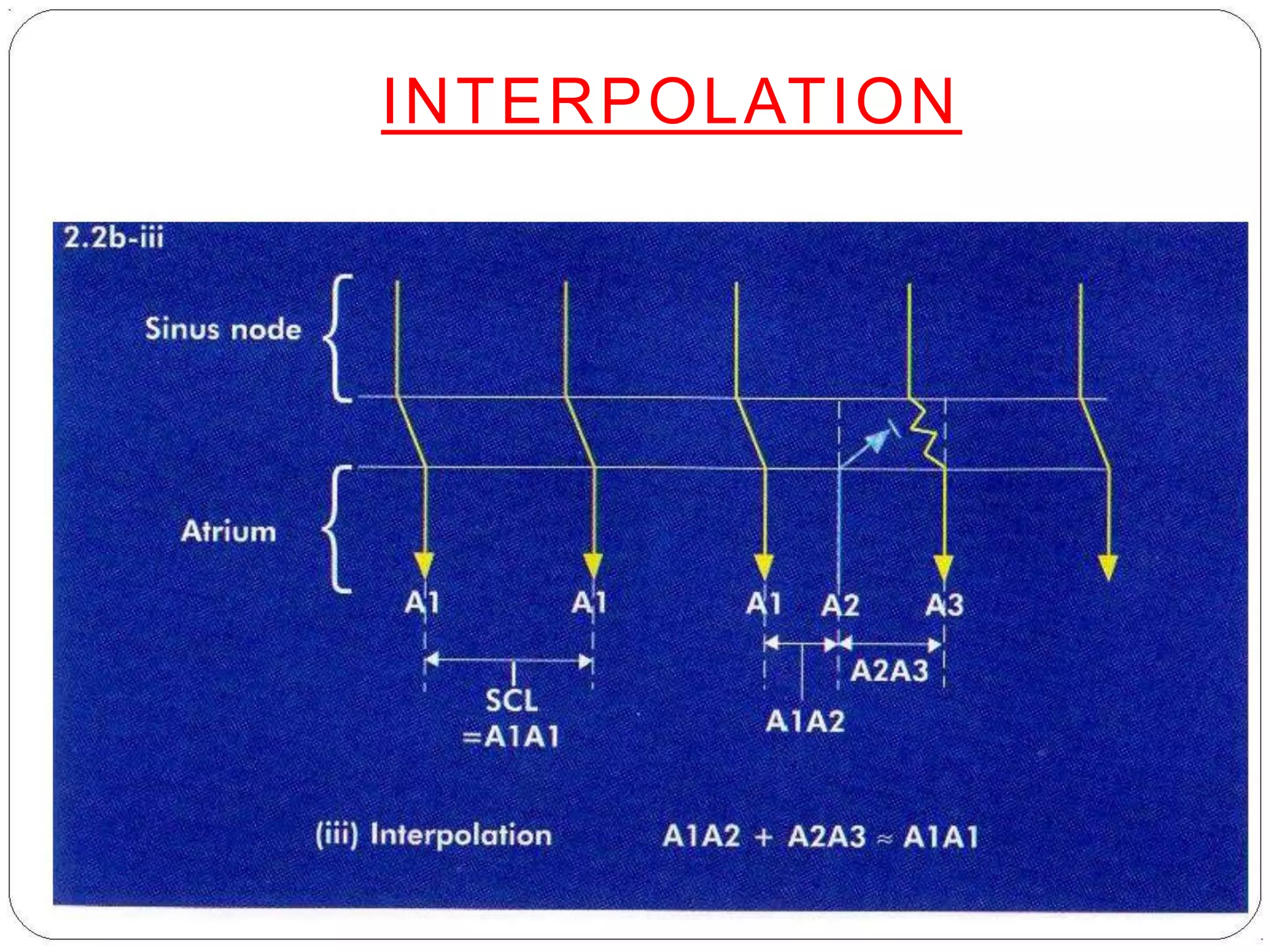 INTERPOLATION
 