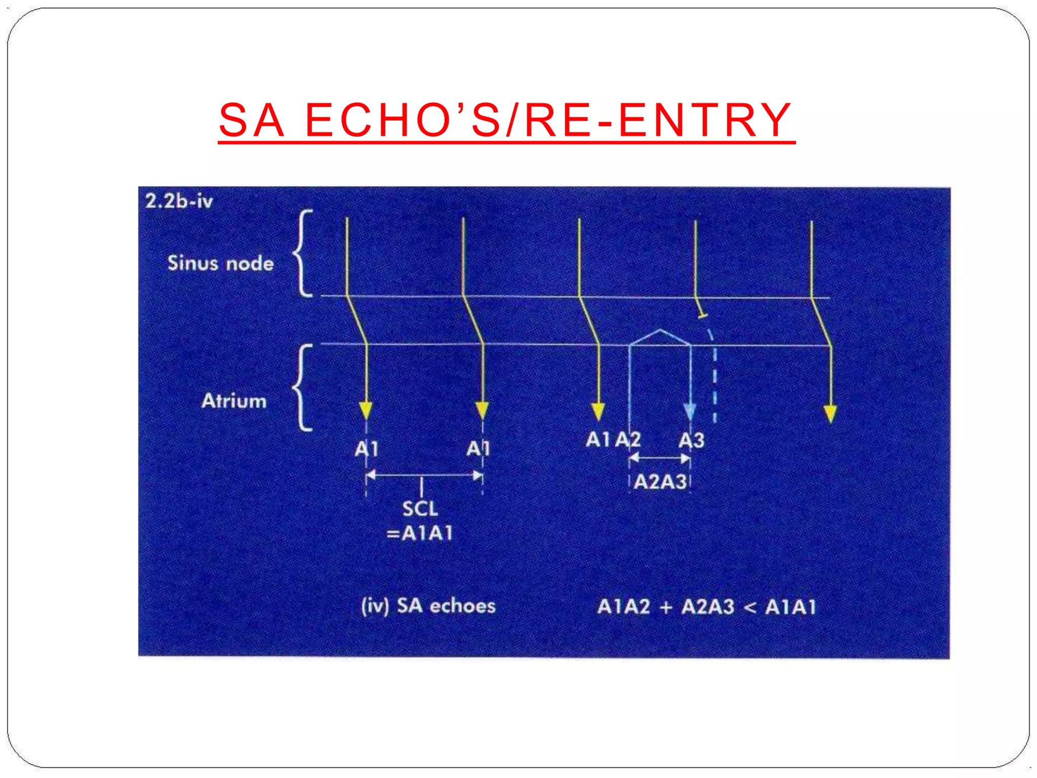 SA ECHO’S/RE-ENTRY
 