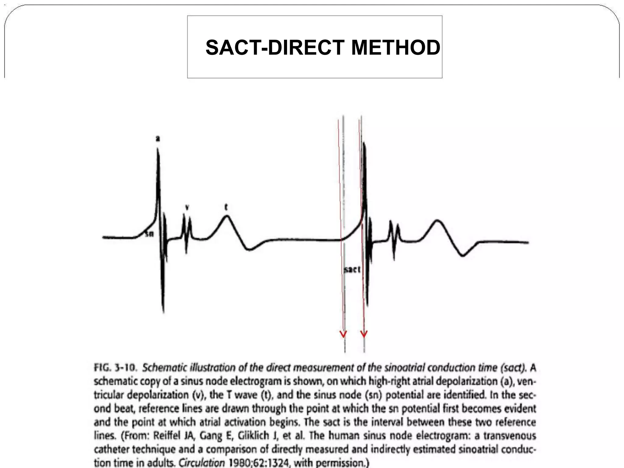 SACT-DIRECT METHOD
 