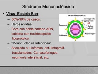 SíndromeMononucléosidoVirus  Epstein-Barr50%-90% de casos.Herpesviridae.Core con doblecadena ADN, cubierta con nucléocapsidelipoproteica. “Mononucleosis Infecciosa”.Asociado a: Linfomas, enf. linfoprolif. trasplantados, Ca nasofaringeo, neumoníaintersticial, etc.