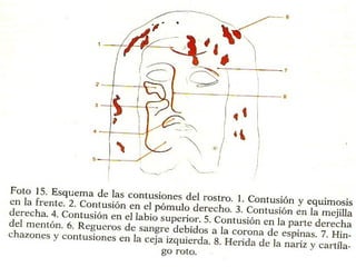 Esa corona-casco habría sido sujetado a la cabeza con una especie de junco 