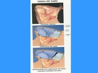 Ese junco sería la “corona” que se halla hoy día en Notre Dame de Paris 