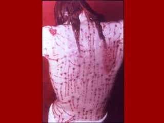 El  suppedaneum  (soporte de los pies) que estamos acostumbrados a ver en nuestros crucifijos, parece no haber existido   