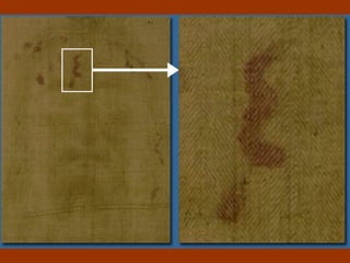 Los pies ¿ Por dónde atravesó el clavo los pies? 