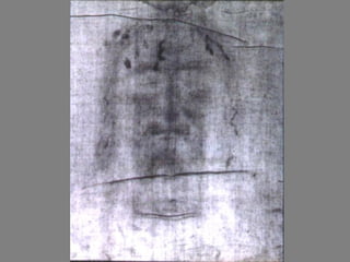 El Dr. Mérat ha estudiado bien las llagas y ha concluído que el clavo debió pasar entre el 2do. y 3ero. hueso cuneiforme del tarso, delante del escafoides.   