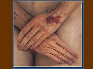 Una última observación: Barbet nos dice que NS no murió reclinando la cabeza hacia el costado como estamos acostumbrados a ver- sino hacia adelante.  Al parecer, la tetanización habría afectado las dos masas musculares del cuello, der. e izq., y en consecuencia la cabeza habría quedado dispuesta simétricamente antes de inclinarse. 