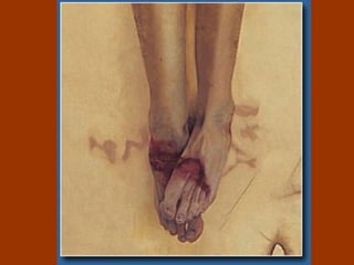 En el caso de NS las especias que llevó Nicodemo (unos 45 kg. de mirra y aloe), parece se utilizaron con el fin de retardar la putrefacción del cadáver, ya que no podría completarse el entierro sino después de más de un día . 