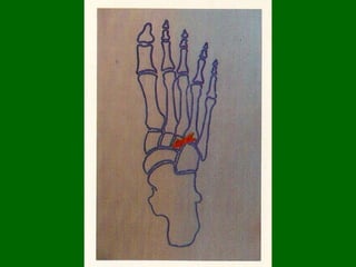 Se ataban pies y manos (recordemos a Lázaro); se ponía un pañuelo alrededor del rostro. Algunos dicen que servía para cerrar la boca del difunto (o sea que se ataba al estilo de los pañuelos cuando dolía una muela…) En cambio el Sudario que se encuentra actualmente en Oviedo habría sido usado solo desde el descenso de la cruz hasta la tumba (sino no aparecería el rostro estampado en la S.S.) 