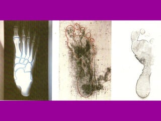 Se envolvía el cuerpo en un lienzo. Al parecer este lienzo era provisorio, hasta que se terminase la preparación del cuerpo. Luego se lo revestía con su túnica. Notemos que en el caso de NS dado que se aproximaba el reposo sabático, no se pudo realizar el rito mortuorio completo. Por ello su cuerpo no fue lavado (sino no habría manchas de sangre) 