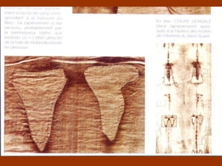 Para ello tuvo que armar un andamiaje, ya la SS pendía sobre el altar mayor   