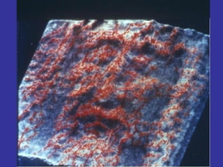 NS estaba completamente desnudo, lo cual se comprueba por el hecho de que las heridas de las nalgas son tan profundas como las del resto del cuerpo. Hay quienes dicen que ni siquiera se salvaron de los golpes las partes pudendas   