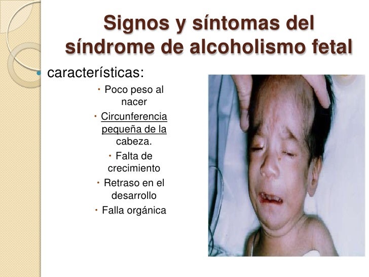 https://image.slidesharecdn.com/sndrome-1-100505211750-phpapp02/95/sndrome-alcoholico-fetal-mejorado1-8-728.jpg?cb=1273094423