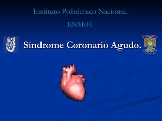 Síndrome Coronario Agudo. Instituto Politécnico Nacional. ENMyH. 