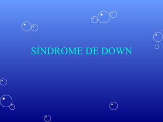 SÍNDROME DE DOWN 