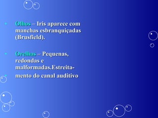 Olhos  – Iris aparece com manchas esbranquiçadas (Brusfield). Orelhas  – Pequenas, redondas e malformadas.Estreita- mento do canal auditivo 