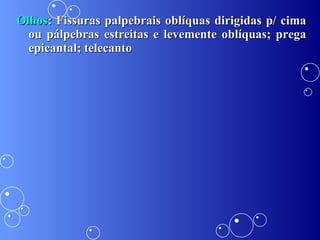 Olhos : Fissuras palpebrais oblíquas dirigidas p/ cima ou pálpebras estreitas e levemente oblíquas; prega epicantal; telecanto 
