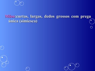 Mãos :curtas, largas, dedos grossos com prega única (simiesca) 