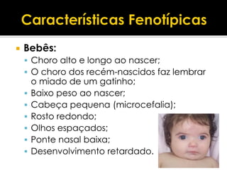    Bebês:
     Choro alto e longo ao nascer;
     O choro dos recém-nascidos faz lembrar
        o miado de um gatinho;
       Baixo peso ao nascer;
       Cabeça pequena (microcefalia);
       Rosto redondo;
       Olhos espaçados;
       Ponte nasal baixa;
       Desenvolvimento retardado.
 