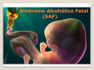 Síndrome Alcohólico Fetal
(SAF)
 