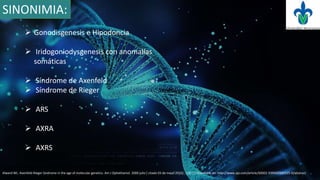 Gonodisgenesis e Hipodoncia
 Iridogoniodysgenesis con anomalías
somáticas
 Síndrome de Axenfeld
 Síndrome de Rieger
 ARS
 AXRA
 AXRS
SINONIMIA:
Alward WL. Axenfeld-Rieger Sindrome in the age of molecular genetics. Am J Ophathamol. 2000 julio [ citado 03 de mayo 2016] ; 130 (1) disponible en: http://www.ajo.com/article/S0002-9394(00)00525-0/abstract
 