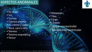 En el ojo
Iris
Cornea
Cámara anterior
En cráneo y cuello
Boca, cara y nariz
Dientes
Sistema esquelético
Fémur
ASPECTOS ANORMALES
Metatarso
Tibia
Carpo.
Corazón
Tabique interauricular
Tabique interventricular
Alward WL. Axenfeld-Rieger Sindrome in the age of molecular genetics. Am J Ophathamol. 2000 julio [ citado 03 de mayo 2016] ; 130 (1) disponible en: http://www.ajo.com/article/S0002-9394(00)00525-0/abstract
 